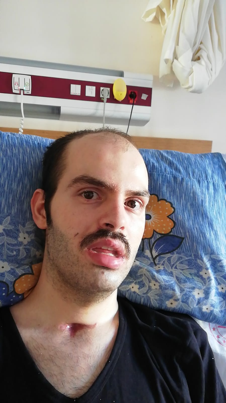 Kök Hücre Tedavisi İçin Yardım Bekliyor